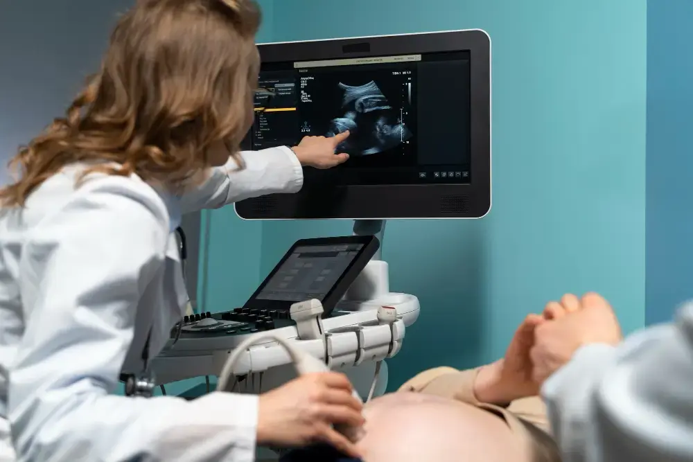 Samsung Medison Mengakuisisi Sonio Startup Ultrasound AI Prancis seharga $92,7 Juta